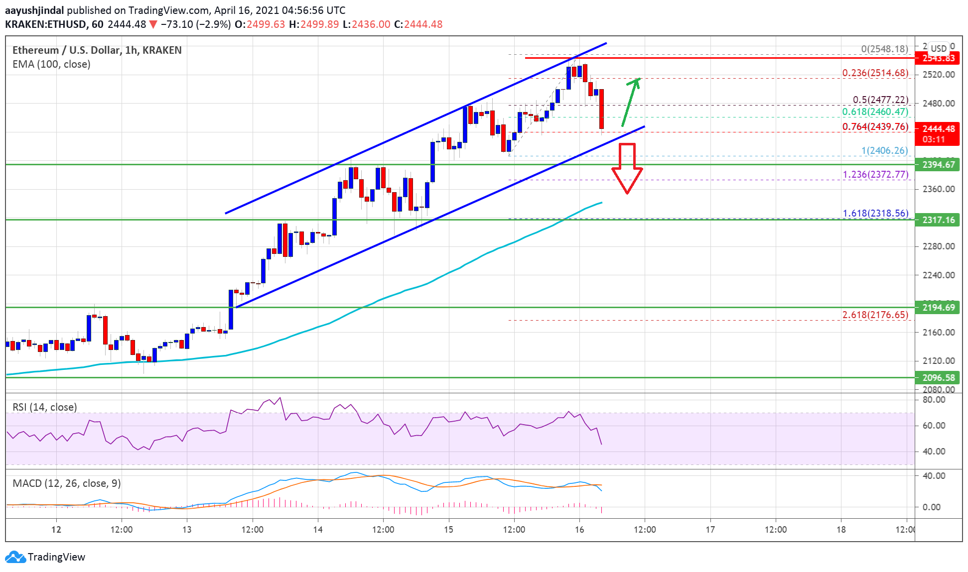 TA: Ethereum Corrects Rally, But 100 SMA Could Spark Fresh Increase