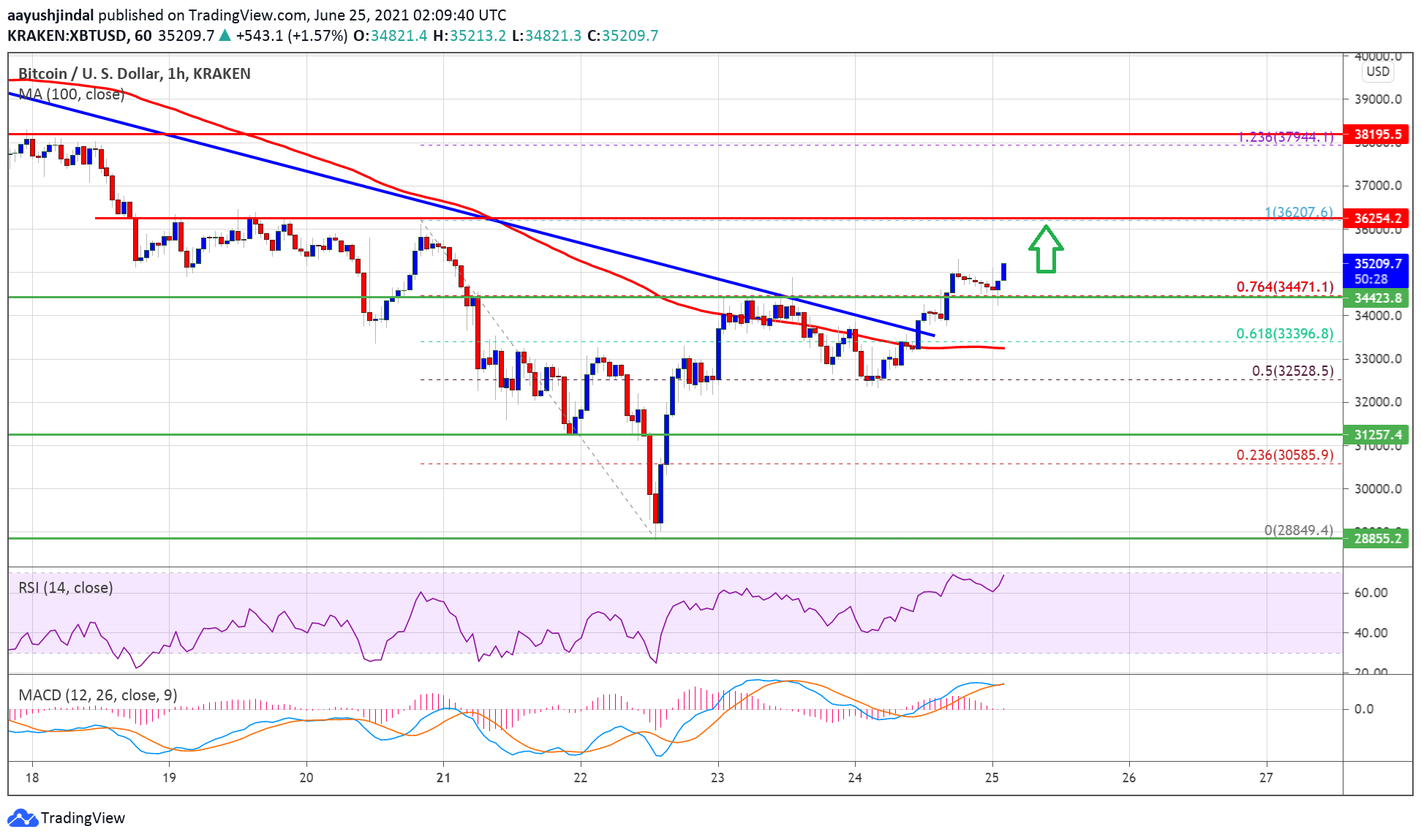 TA: Bitcoin Breaks $35K, Why BTC Bulls Aim A Larger Rally