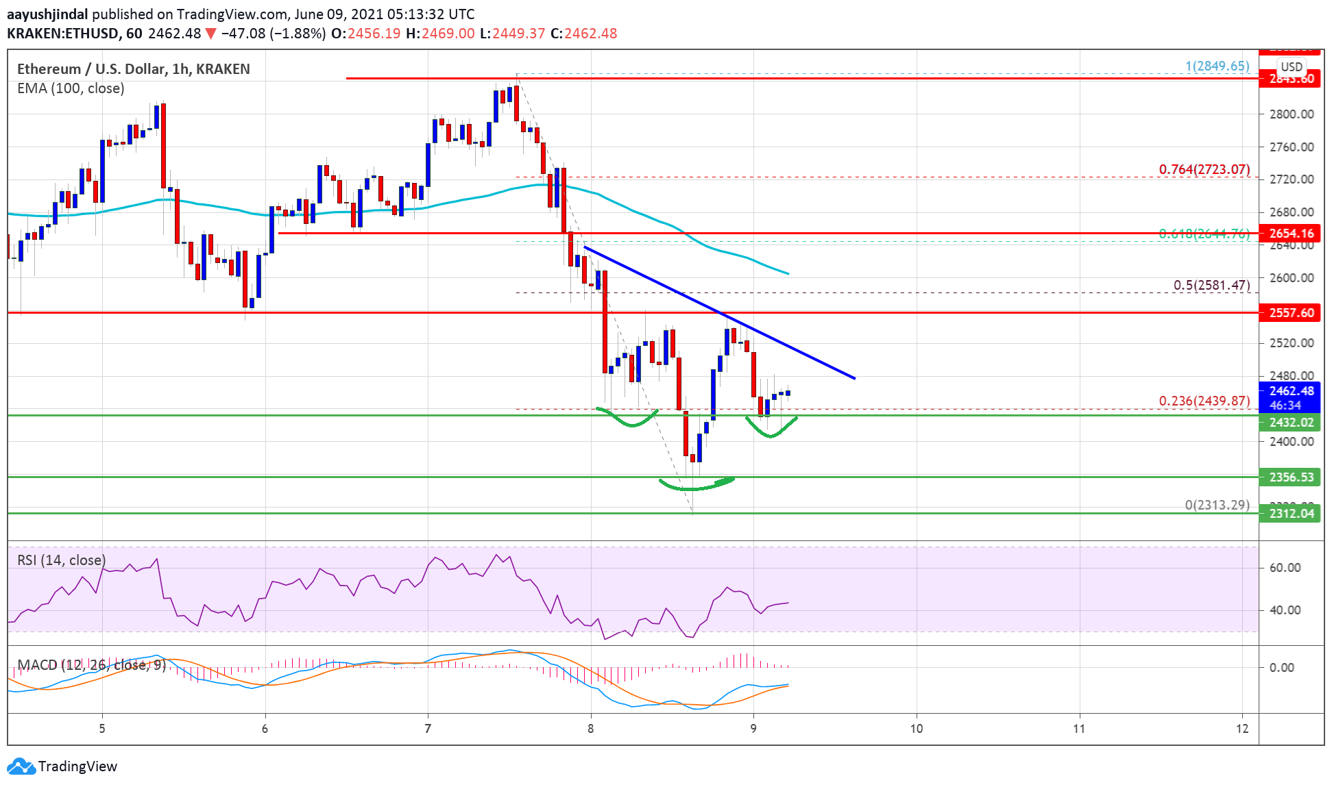 TA: Ethereum Signals Recovery, How ETH Could Start A Strong Increase