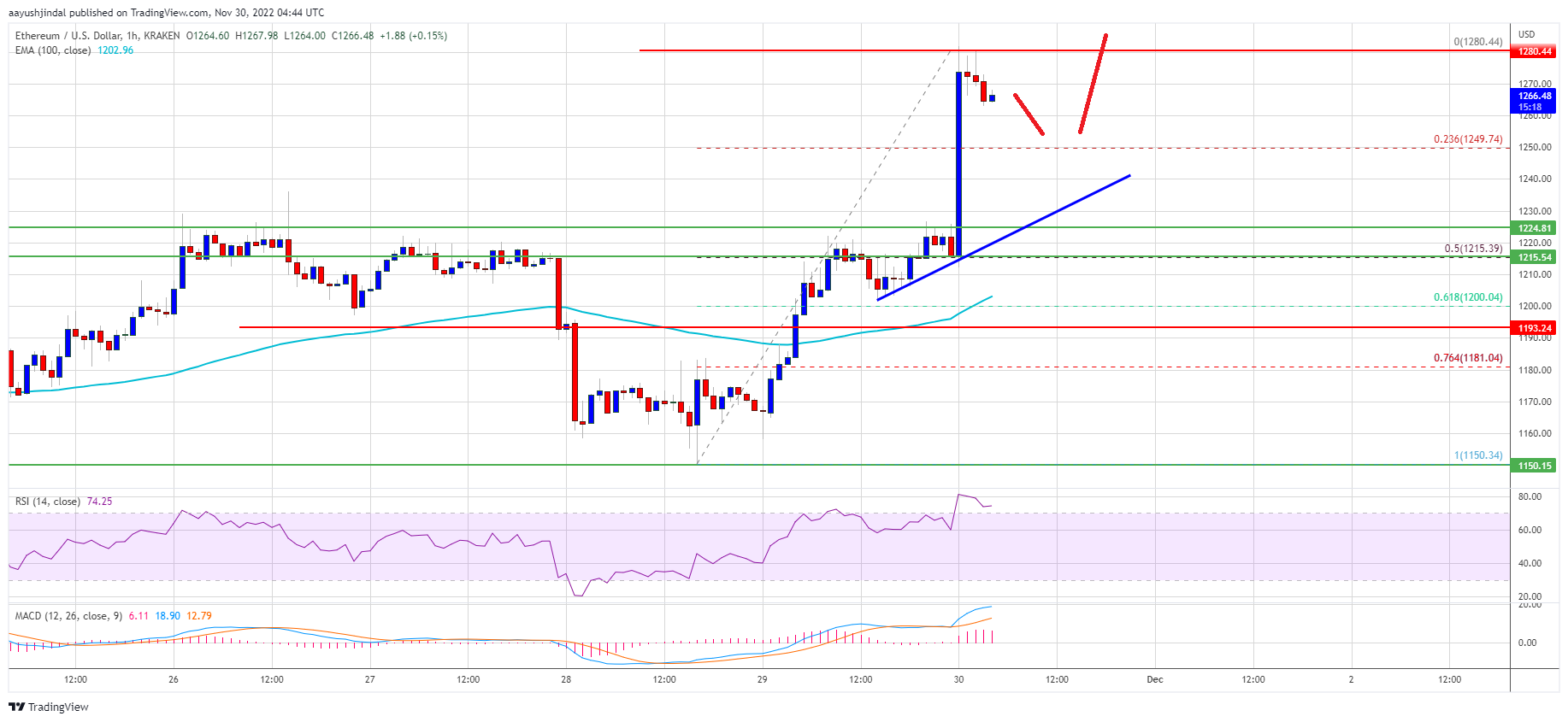 Ethereum Price Offers Trade Opportunities After Recent Bullish Breakout