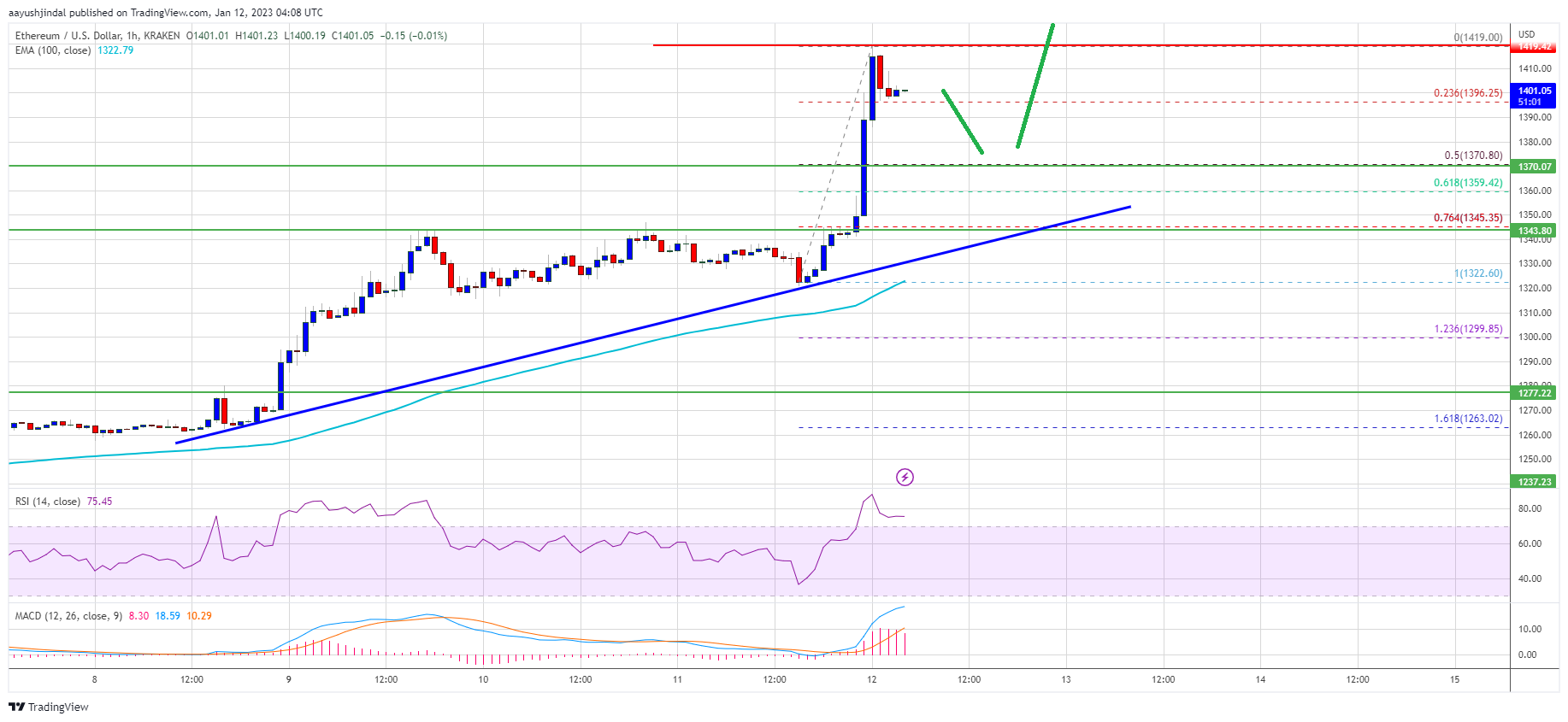 Ethereum Price Climbs 5% To Take Out Hurdles, Is Bottom Really In?