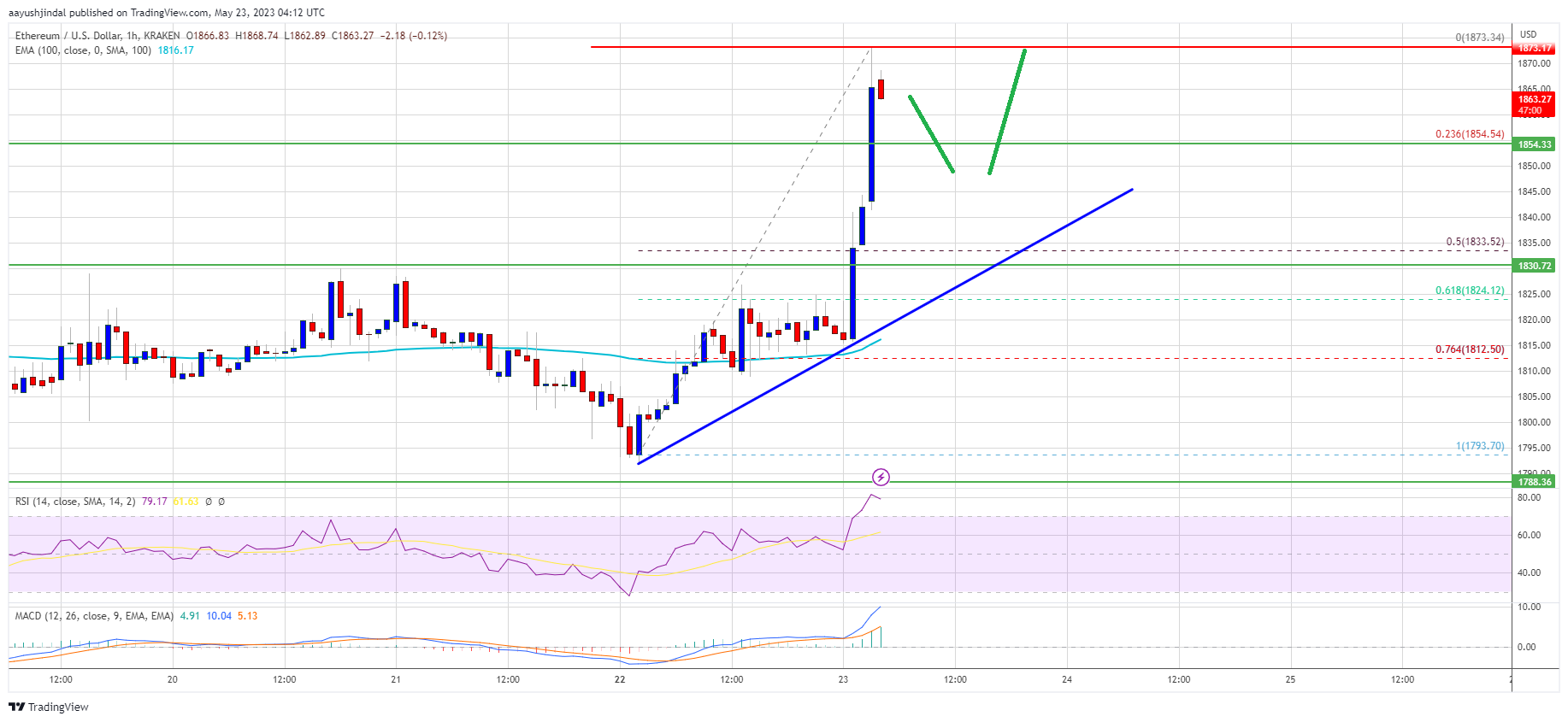Ethereum Price Sees Bullish Breakout And Why Dips Turn Attractive