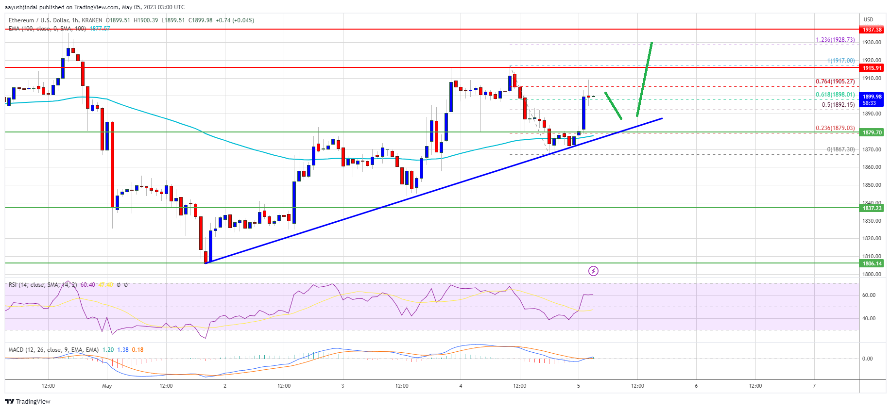 Ethereum Price Showing Signs of Fresh Rally But This Resistance Is The Key